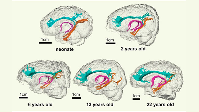 Charla sobre el funcionamiento del cerebro de los adolescentes.