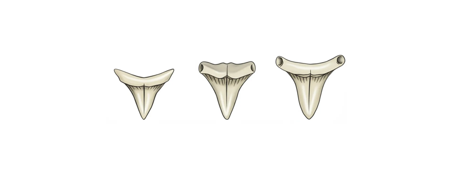 Dientes de Tiburón